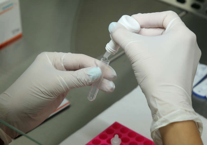 Novi korona presjek upozorava: U Srbiji zaraženo još 579 ljudi, tek 50 odsto odraslih primilo vakcinu