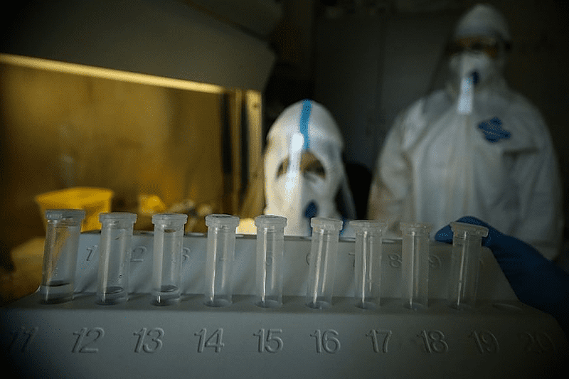 PREMINULO 57 PACIJENATA U Srbiji registrovano 7.818 novih slučajeva virusa korona