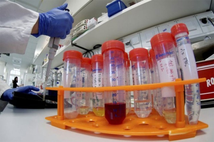 Evropa na udaru virusa korona: Sve više zemalja bilježi rekordne brojke