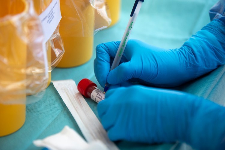 U Srpskoj 230 novozaraženih koronom, 18 smrtnih slučајеvа