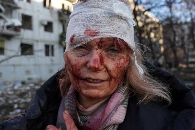 ZA SVE KOJI PRIZIVAJU RAT U BOSNI I HERCEGOVINI Potresni, jezivi snimci iz UKRAJINSKOG RATA /VIDEO/