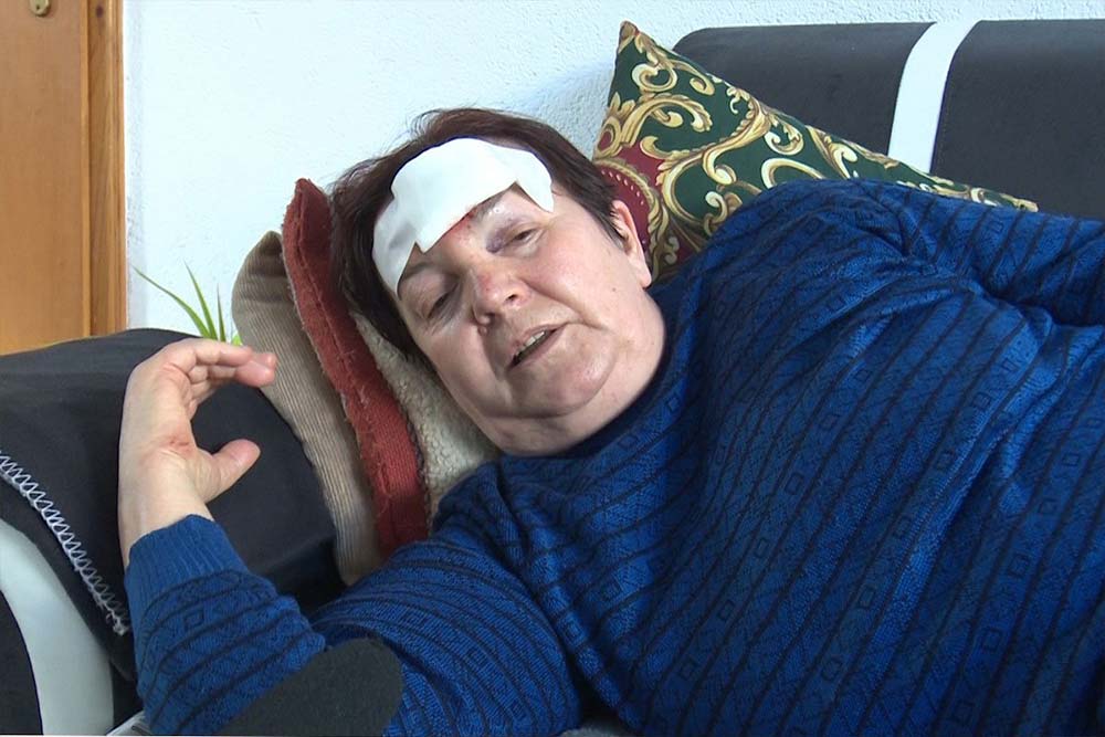 ŽENA TEŠKO POVRIJEĐENA: Presreli je agresivni psi