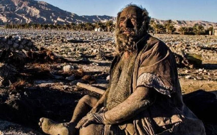 NIJE SE KUPAO 67 GODINA Doktori kažu da je savršenog zdravlja /VIDEO/