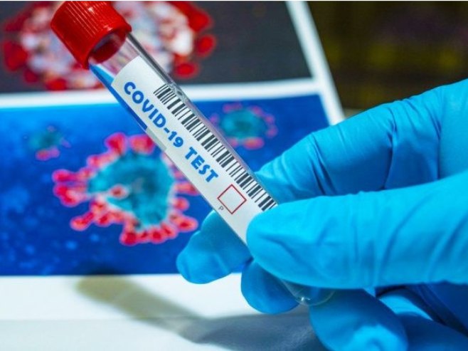 U Srpskoj preminulo 16, zaraženo 379 osoba