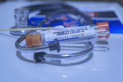 Zaraženo 30.837 lica, preminulo 936