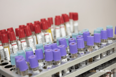 NAJTEŽE PONOVO U SARAJEVU U FBiH na koronu pozitivna još 121 osoba, preminuo jedan pacijent