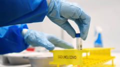 U svijetu koronavirusom zaraženo više od 89 miliona ljudi