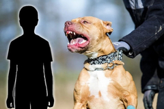 Pas ujeo dijete u Beogradu, amputiran mu prst