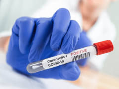 Srbija: Potreban pi-si-ar test za strance