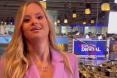 Prvi model sa Daunovim sindromom u kampanji za poznati brend (FOTO)