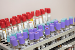 Opada broj zaraženih u BiH, ostaju epidemiološke mjere