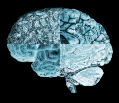 Obdukcije preminulih od korone pokazale uočena oštećenja na mozgu nalik onim nakon moždanog udara, doktori potpuno iznenađeni