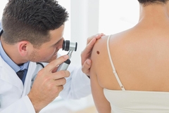 Naučnici napravili VELIKI KORAK! Pronašli način u liječenju melanoma