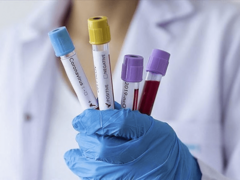 U FBiH 690 novozaraženih, preminulo 37 osoba