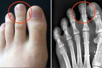 EVO ZAŠTO SAMO 14% STANOVNIŠTVA IMA DUŽI DRUGI PRST: Gledaćete ih drugim očima!