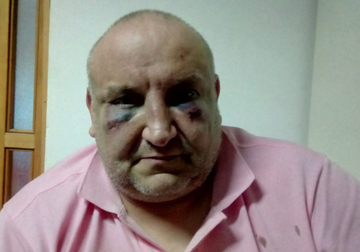 Šmrkao kokain, pa "popio" batine: Detalji razbojništva u hotelu Bosna