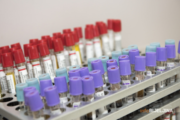 PREMINULO 16 LJUDI U FBiH zaraženo još 615 osoba