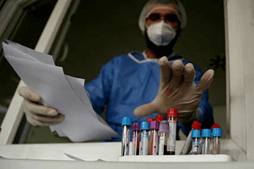 PREMINULO SEDMORO ZARAŽENIH Na korona virus pozitivne još 63 osobe u Srpskoj