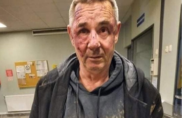 Tvrdi da ga je pretukla policija nakon što je izvršio malu nuždu