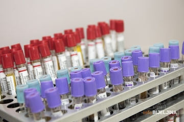 Institut za javno zdravstvo: Velika moć širenja delta soja, pridržavanje mjera neophodno