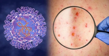 Majmunske boginje i u Srbiji! Donio muškarac koji je radio u Njemačkoj