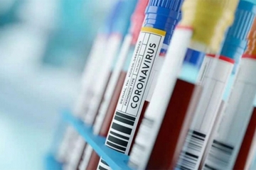 U BiH od jula nijedan registrovan slučaj delta soja virusa korona