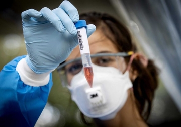 Prijavljeno devet smrtnih slučajeva: Korona virus potvrđen kod još četiri osobe u Srpskoj