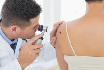 Naučnici napravili VELIKI KORAK! Pronašli način u liječenju melanoma