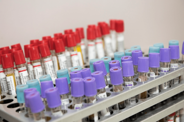 "Biće dovoljno brzih testova na kovid za zdravstveni sektor RS"