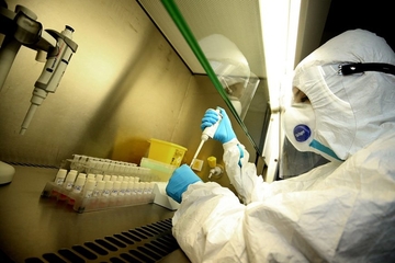 PREMINULE TRI OSOBE U Kantonu Sarajevo 153 novozaraženih virusom korona